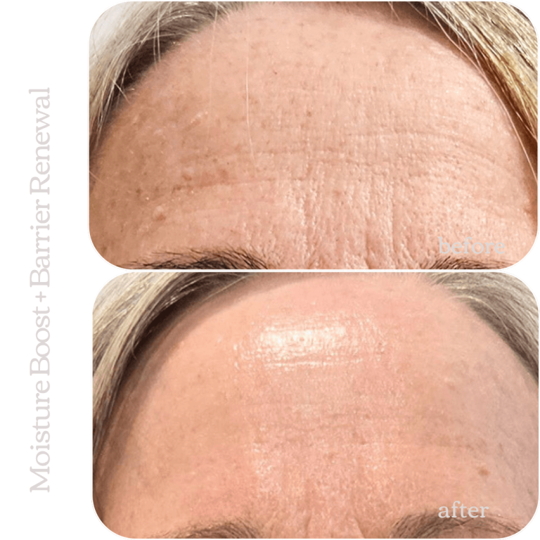 Moisture Boost and Barrier Renewal